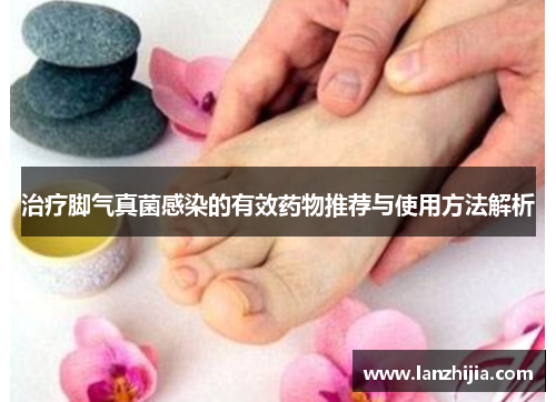 治疗脚气真菌感染的有效药物推荐与使用方法解析